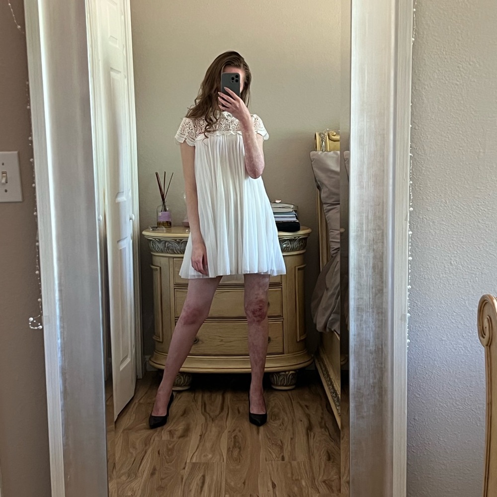 ASOS Rhinestone Lace Dress - Picture 1 of 9